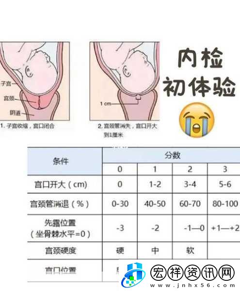 內(nèi)檢的時候醫(yī)生手剝了一圈